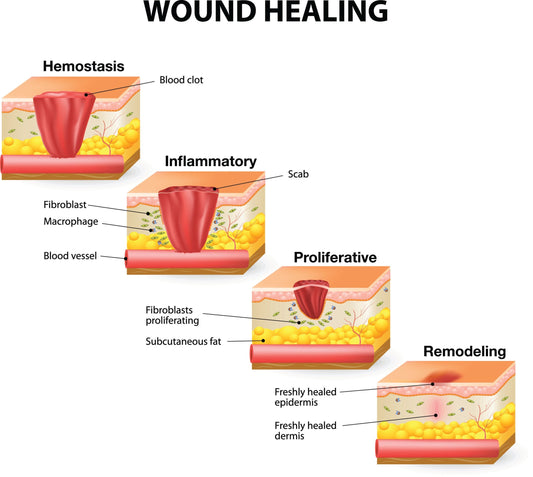 why your piercing wont heal in 6 weeks