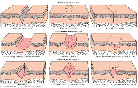 Signs Your Piercing Is Healing Normally: What's Normal and What's Not?