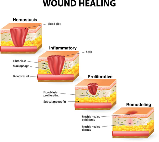 why your piercing wont heal in 6 weeks