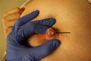 inverted nipple piercing